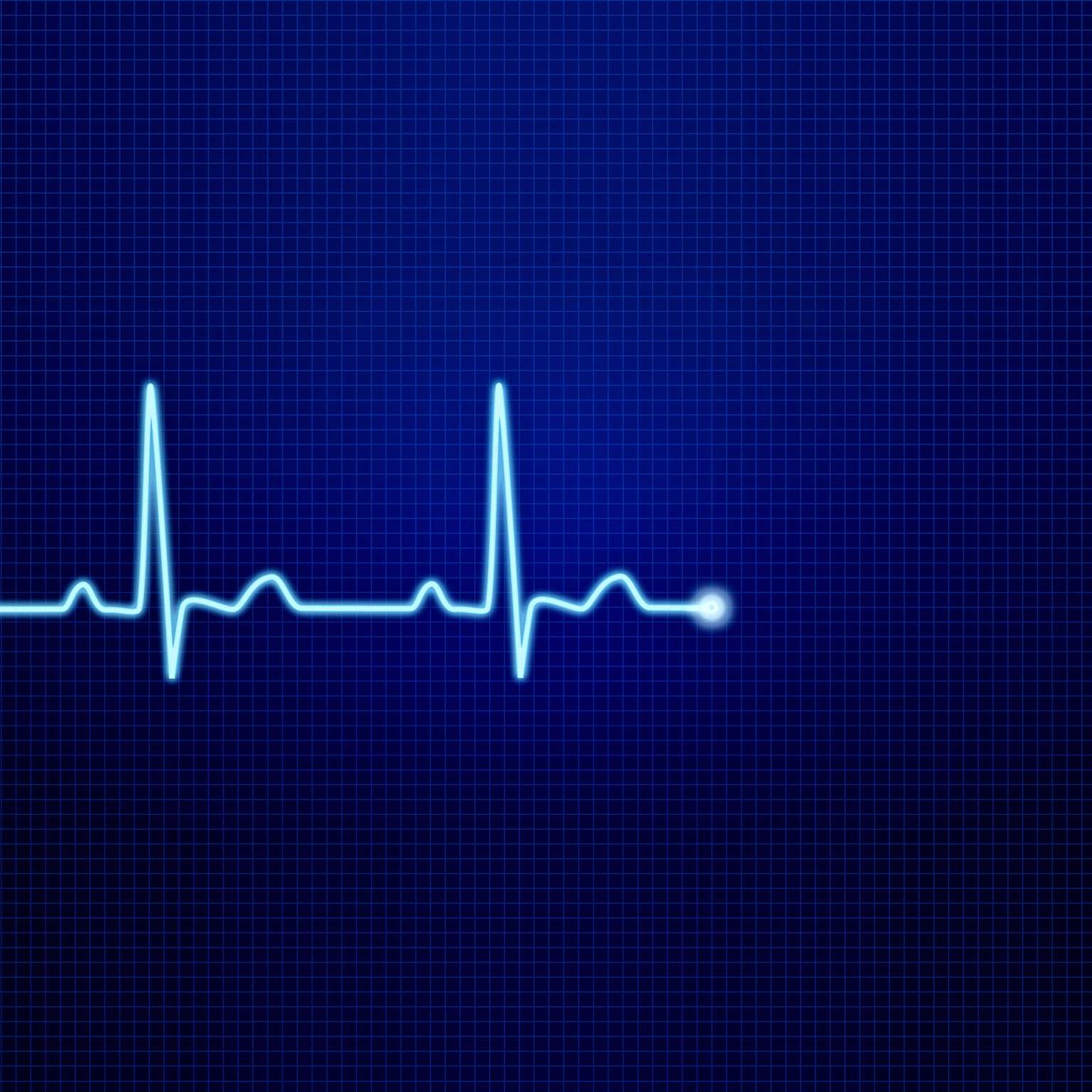  Image of an EKG pulse waveform.