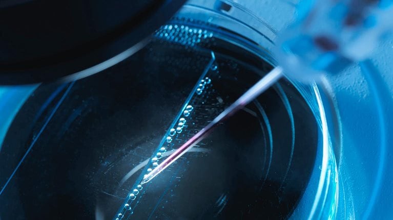 Can European biotechs achieve greater scale in a fragmented landscape?