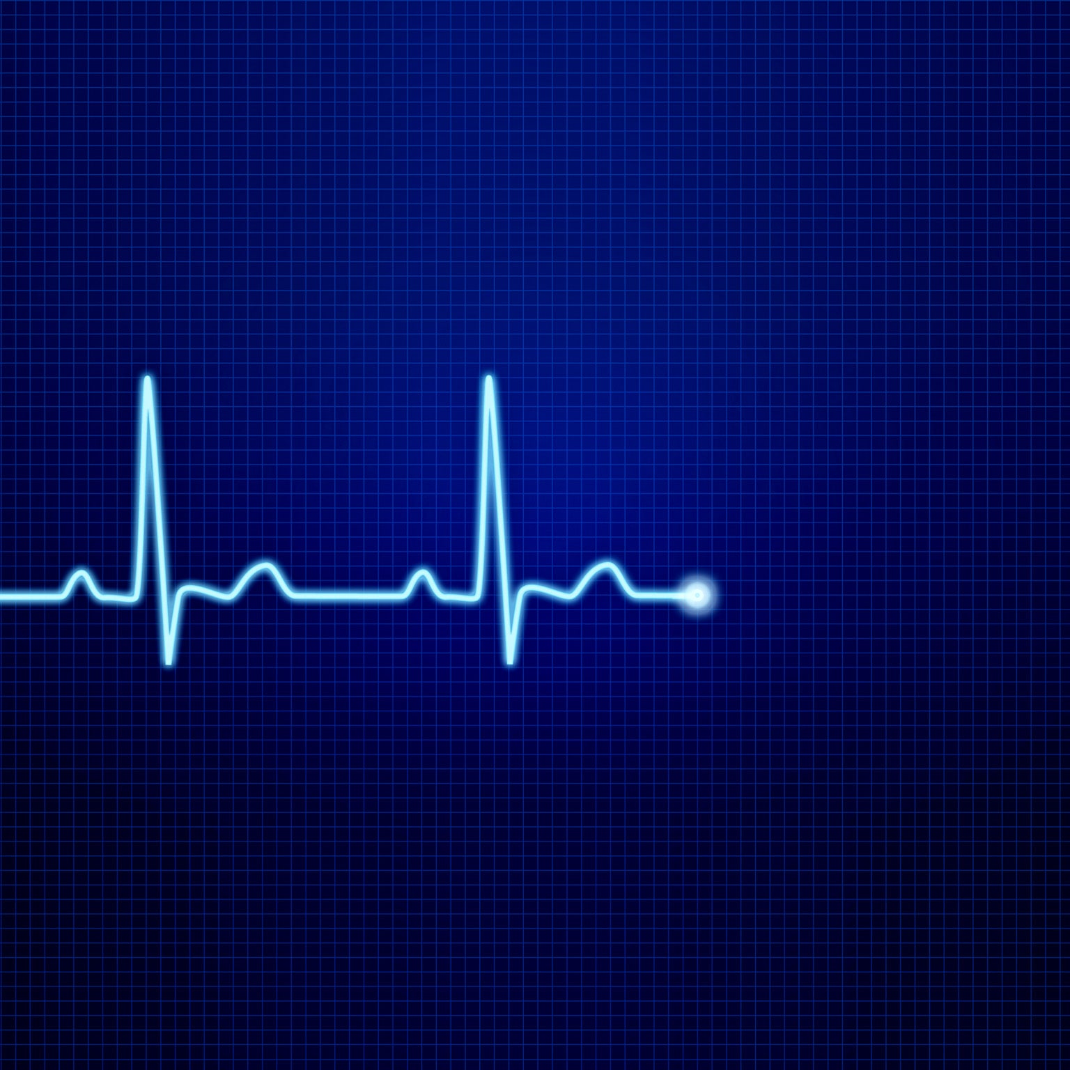  Image of an EKG pulse waveform.