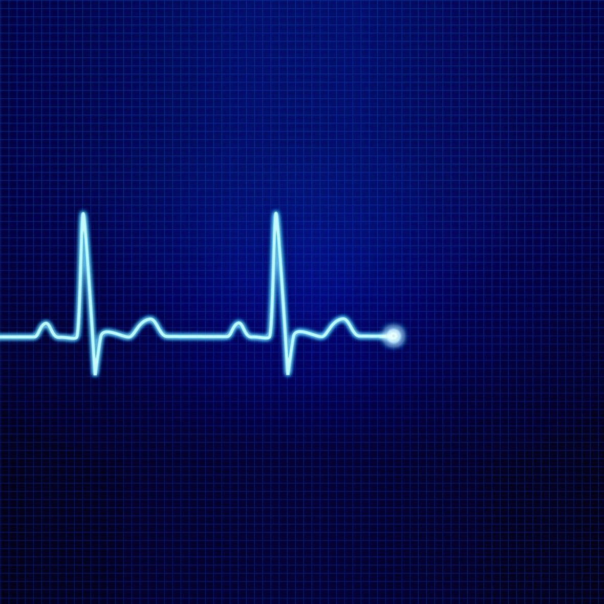 Image of an EKG pulse waveform.